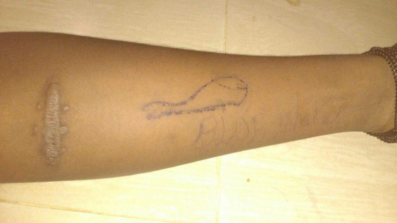 Teen's Suicide Linked To Blue Whale; 75 More Playing, Suspect Tamil Nadu Police