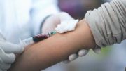 9-yr-old leukaemia patient contracts HIV after blood transfusion